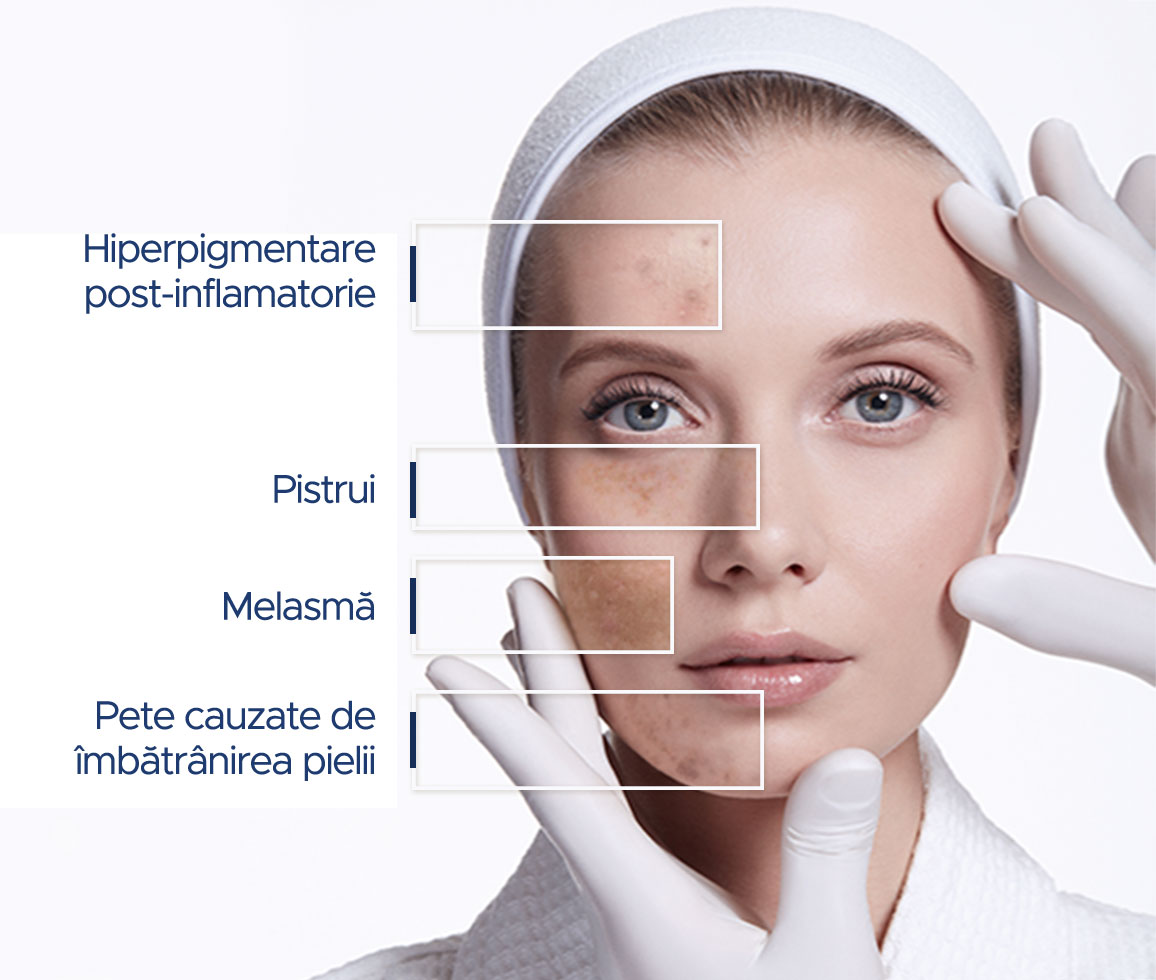 ENG_dclar_macchie_cutanee